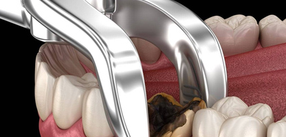 Kids Dentist in Goregaon