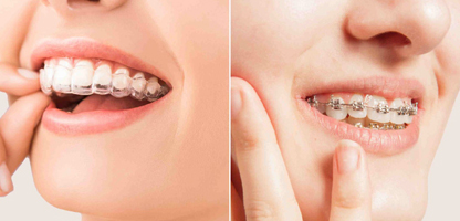 Dental Pain Treatment in Goregaon