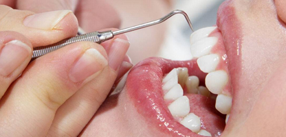 Gum Treatment in Goregaon